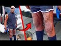 WHAT THE HELL HAPPENED TO RONNIE COLEMAN S LEGS