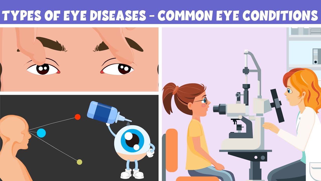 Types of Eye Diseases - Common Eye Conditions - Learning Junction Video
