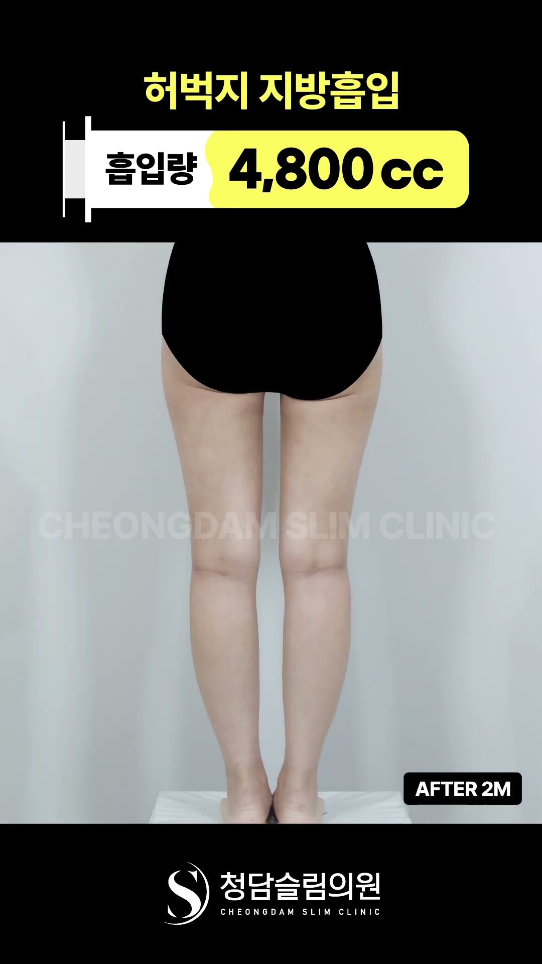 누가 내 다리 늘렸냐고