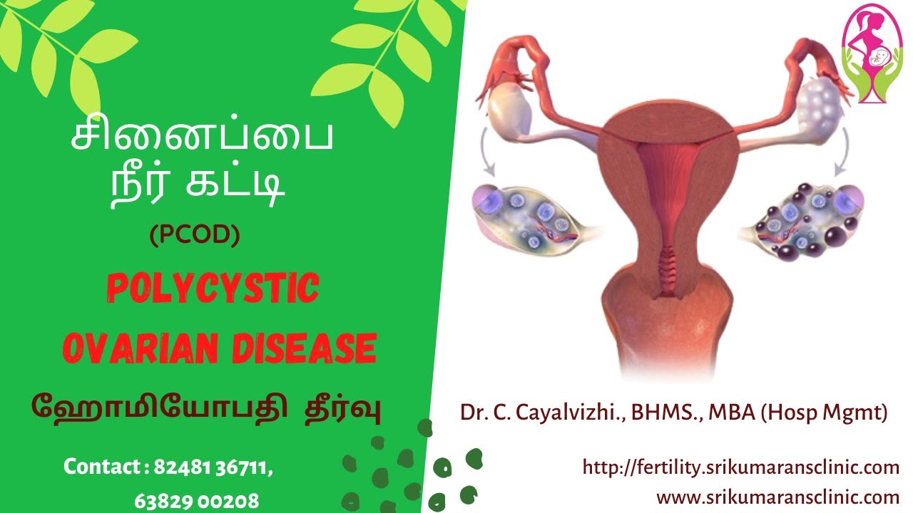 PCOD & Homoeopathy -Tamil Version