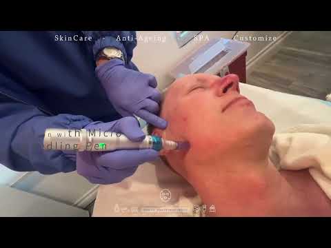 Up to 81% Off Collagen-Boosting Micro-needling with PRP at Our Secret Place Medical Spa - Second Medium