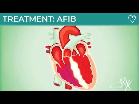 Treatment for Atrial Fibrillation (AFIB)