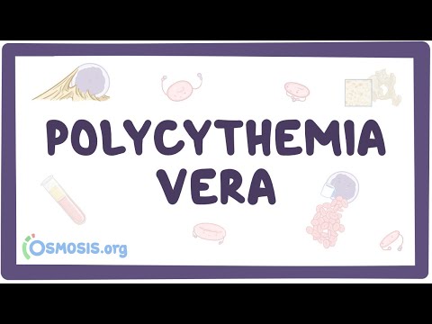 Polycythemia vera - causes, symptoms, diagnosis, treatment, pathology
