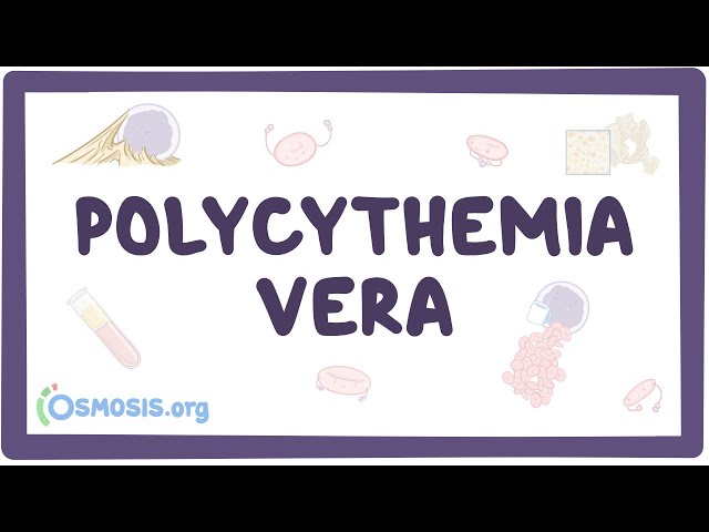 Video Aussprache von Polycythemia vera in Englisch