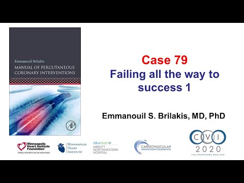 Case 79: PCI Manual - Failing all the way to success 1
