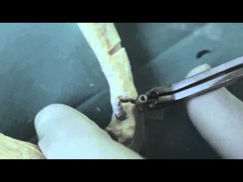 3 -bd / Verfahren B001-Implantate