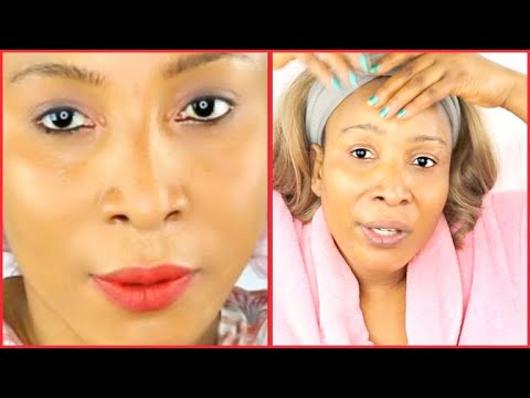 OMG! I GET RID OF MY LAUGH LINES AND MOUTH WRINKLES WITHOUT FILLERS, LOOK WHAT I USE, AMAZING!