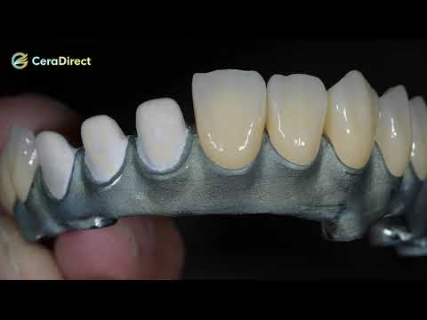 Ceradirect Max multilayer dental zirconia