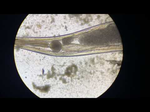 Aschelminthes phylum