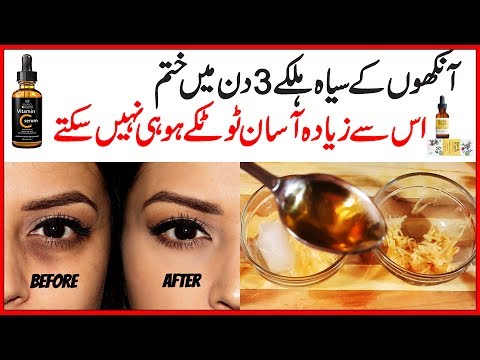 Remove Dark Circles Natural Home Remedies Also Get Rid of Under Eye Wrinkles in 3 Days Urdu Hindi Video
