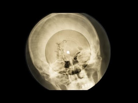 What is the Soviet X-Ray music?