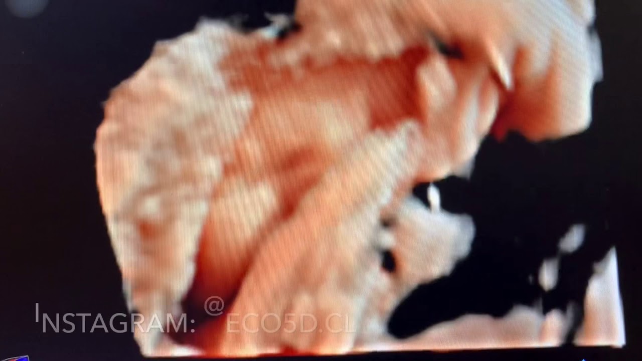 Benjamín Villarroel Castillo-19