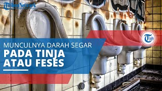 Hematochezia, Munculnya Darah Segar pada Tinja (Feses) yang Berwarna Merah Muda