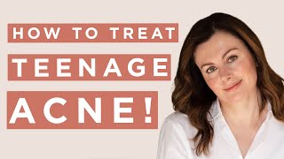 How To Treat Teen Acne | Dr Sam Bunting