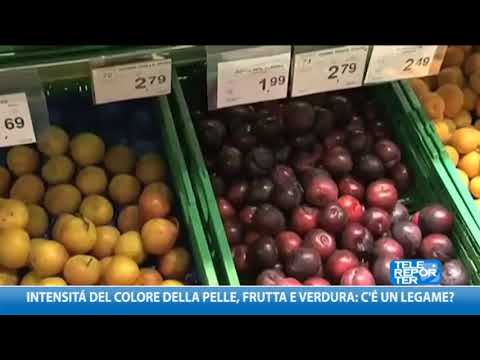 Musica di una canzone di una lentiggine Rassegne di un limone a posti di pigmentary
