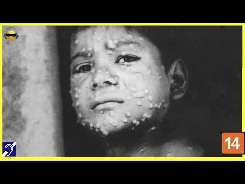 Tv Educativa Cortes Netflix Explicando A Próxima Pandemia Dublado e com Legendas Surdez Hipoacusia  Corte 05