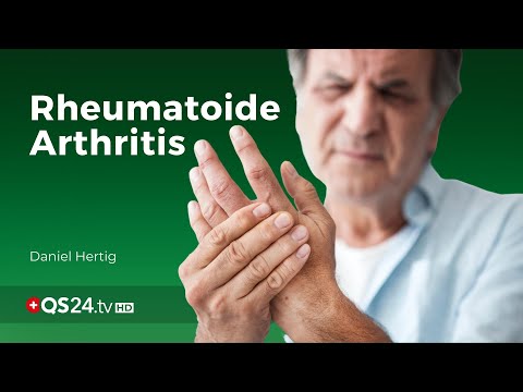 Rheumatoide Arthritis in den Griff bekommen | Naturmedizin | QS24 Gesundheitsfernsehen