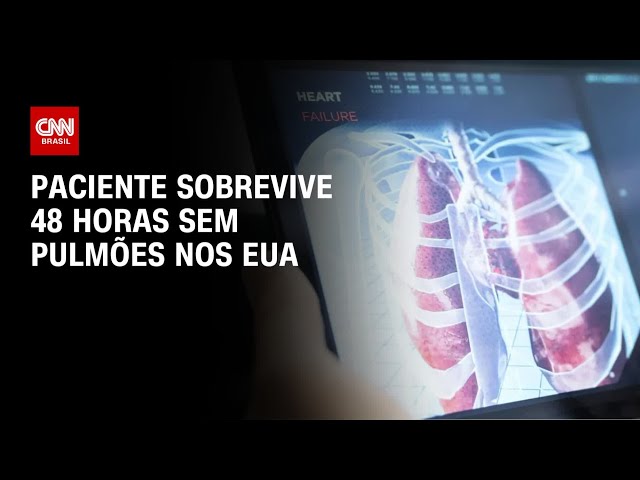 Paciente sobrevive 48 horas sem pulmões nos Estados Unidos | AGORA CNN