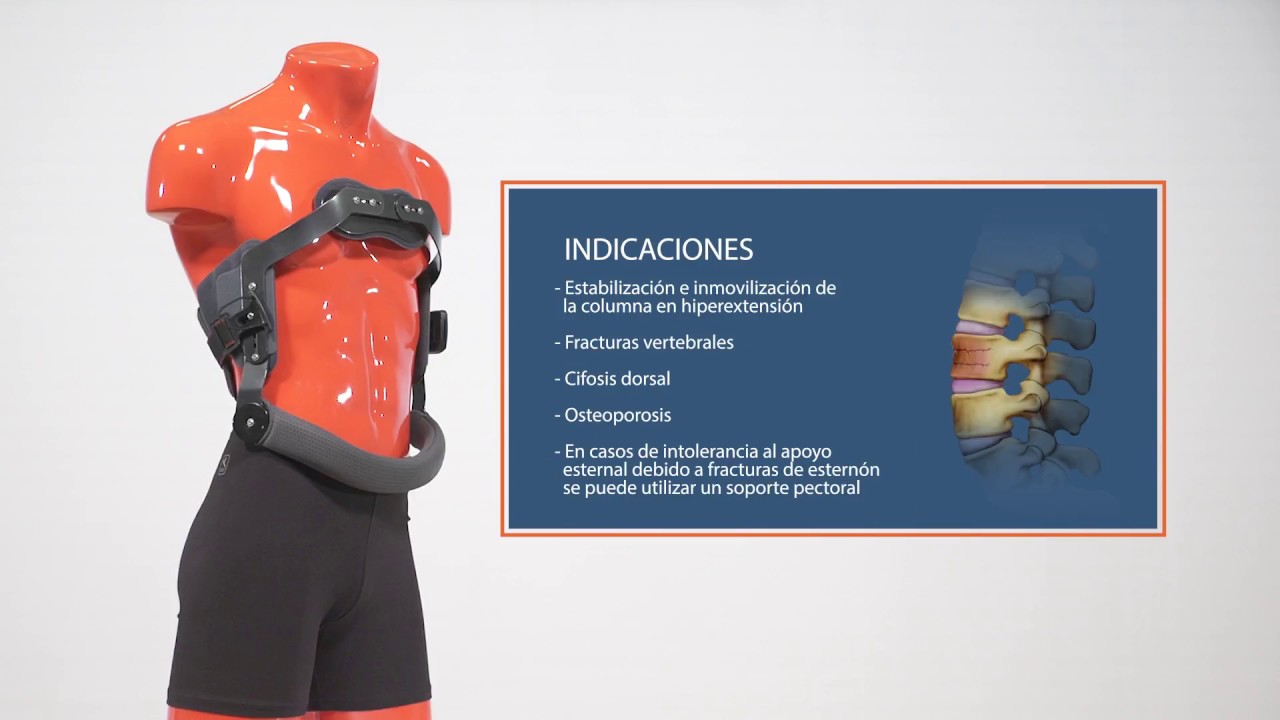 Orliman Jewett Sternotech®