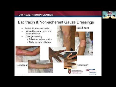 Project ECHO (SICK): Wound Care - The Basics and Beyond