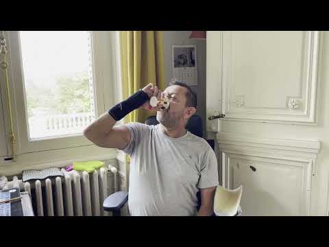 Just over one year after arm transplant