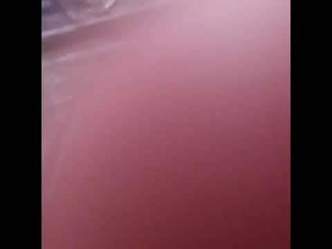 KNOXY Vs Ryan Boyle 2  (03/06/2023)