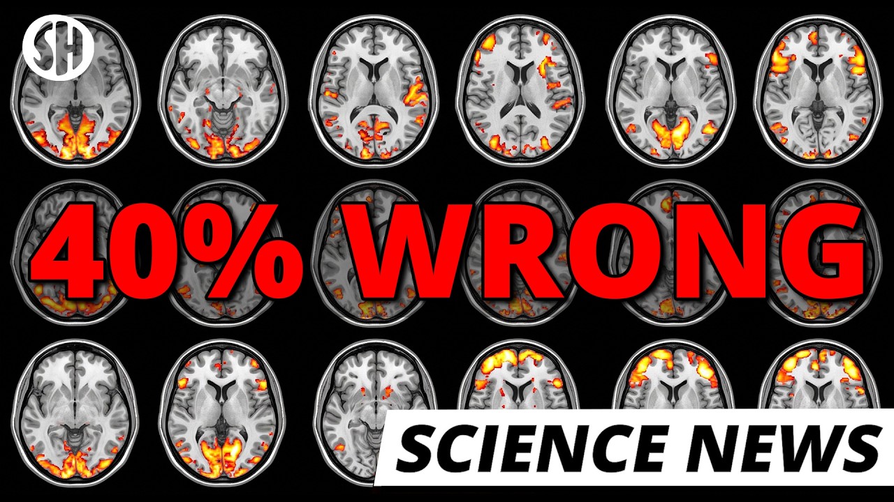 Neuroscientists Have Been Misreading Brain Scans for Decades