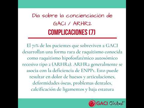 Presentación GACI
