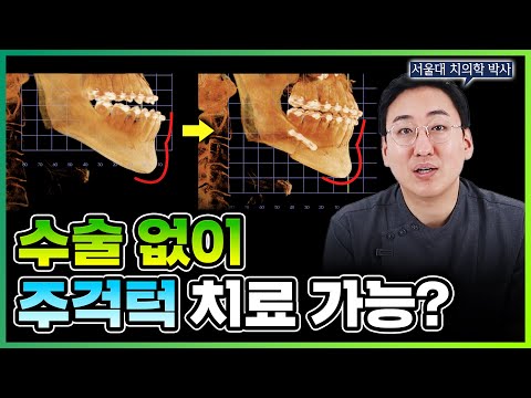 주걱턱 교정? 수술? 딱 정리해드립니다.