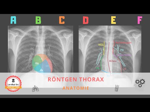 Anatomie im Röntgen Thorax – Grundlagen für Studium & Weiterbildung