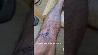 Picking my Giant scab after a Soccer Game (Part 1 ?)