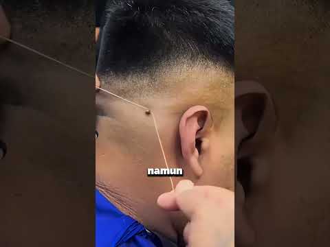 Mengikat tonjolan kecil di kulit!! #informatif #faktaunik