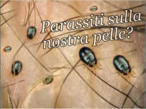 Come trattare un gatto vermi video Dovè possibile esser trattato vermi
