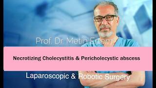 Miniaturka - Necrotizing Cholecystitis & pericholecystic abscess. Metin Ertem MD.FACS