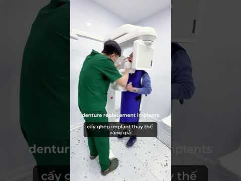 All-on-4 IMPLANTS IN VIETNAM - Chewing Restored in  #dentist #saigondentalhospital
