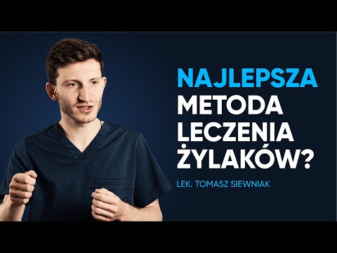 Jaka metoda leczenia żylaków jest najskuteczniejsza?