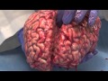 The Unfixed Brain 