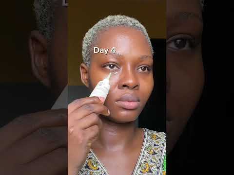 KSecret Retinal Eye Cream 7days Transformation. #skincare #skincarereview #eyecream #darkcircles