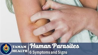 6 Symptoms of Human Parasites Everyone Should Know