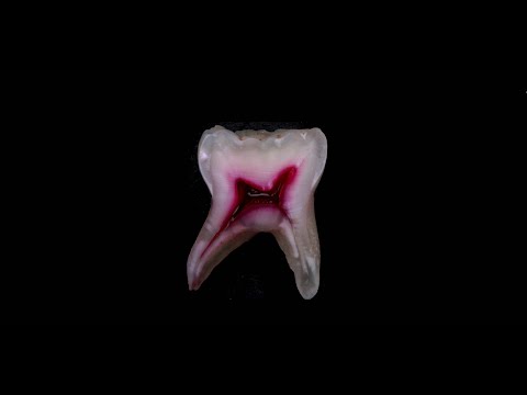 Строение зуба - краткая гистология