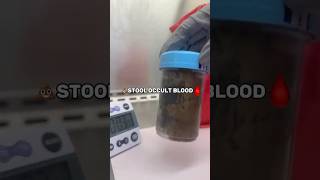 HOW TO: STOOL OCCULT BLOOD! 🩸💩 #mls #laboratorylife #stool #blood
