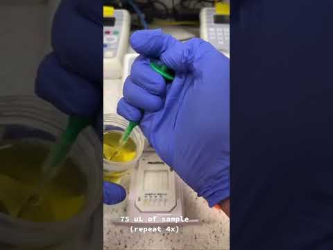 Urine Drug Screen: How it’s Done 🧪
