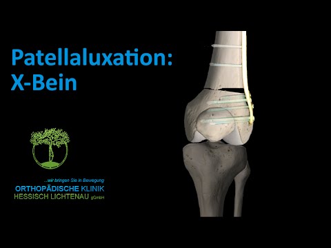 Rückenschmerzen im Lendenwirbel Schmerzmittel im Schultergelenk
