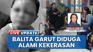 Fakta Balita Babak Belur Diduga Korban Penganiyaan di Garut, Alami Luka Lebam hingga Tulang Rapuh