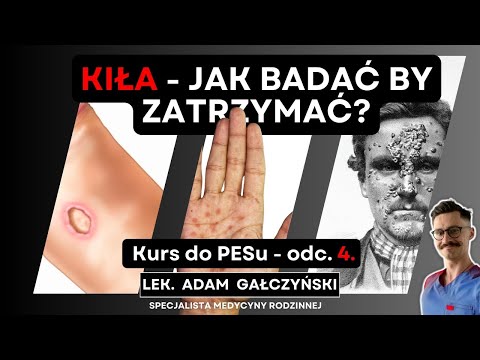 Kiła - jak często powinnaś/powinieneś się badać?