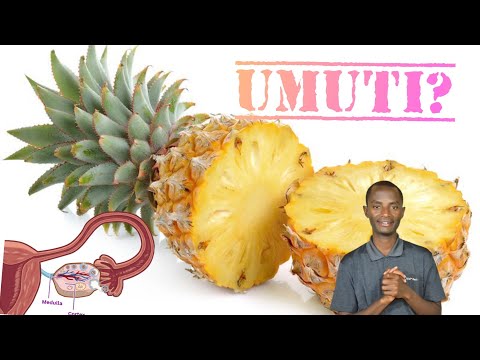 Rinda ubuzima family and IGIKONI KIVURA