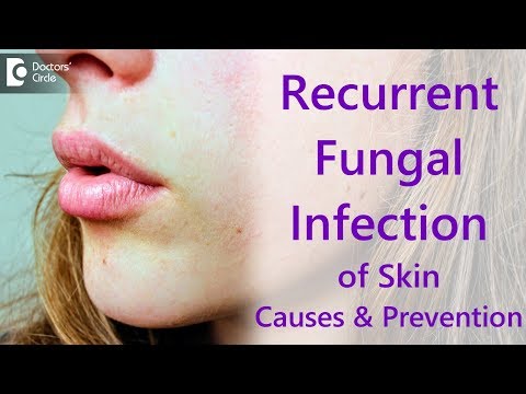 Why do i get recurrent fungal skin infections? - Dr. Amee Daxini