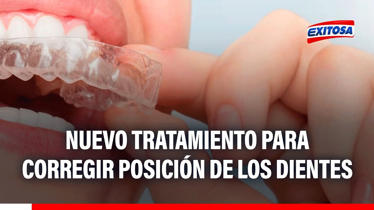 🔴🔵 Nuevo tratamiento para corregir la mala posición de los dientes