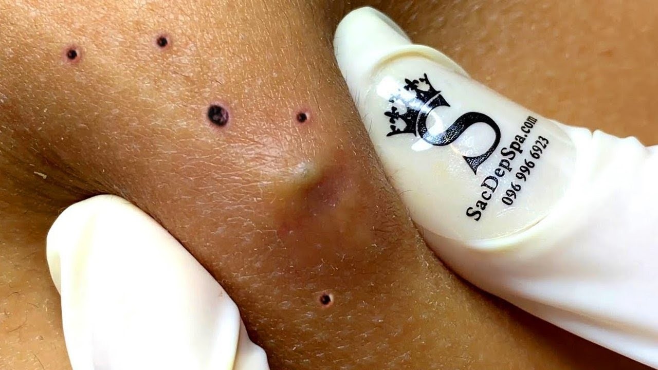 𝑺𝒐𝒐𝒕𝒉𝒊𝒏𝒈 𝑭𝒂𝒄𝒊𝒂𝒍 𝑻𝒓𝒆𝒂𝒕𝒎𝒆𝒏𝒕 𝑭𝒐𝒓 𝑺𝒕𝒓𝒆𝒔𝒔 𝑹𝒆𝒍𝒊𝒆𝒇 𝒂𝒕 𝑳𝒖𝒙𝒖𝒓𝒚 𝑺𝒑𝒂 𝑨𝒄𝒉𝒊𝒆𝒗𝒆 𝑰𝒏𝒏𝒆𝒓 𝑷𝒆𝒂𝒄𝒆 #887981