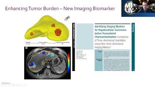 Biomarkers in Liver Interventional Oncology: Where are we going? - Julius Chapiro